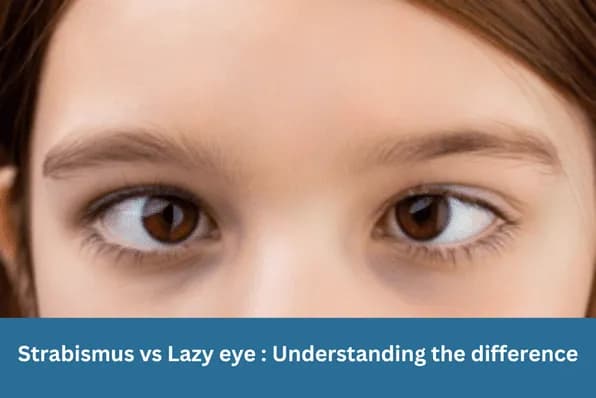 Strabismus vs Lazy eye: Understanding the difference