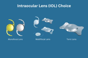 Intraocular Lens (IOL)