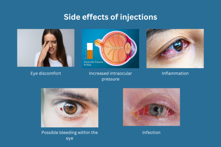 Side effects of injections